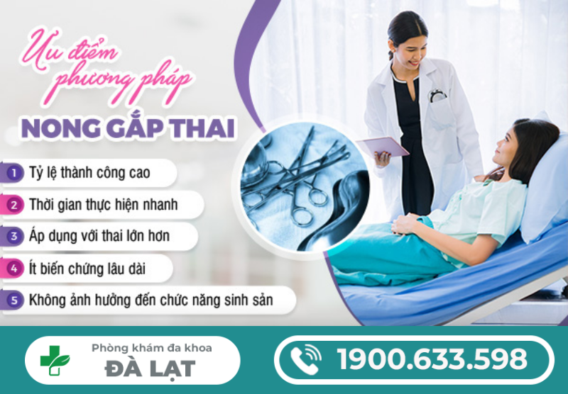 Hình ảnh minh họa